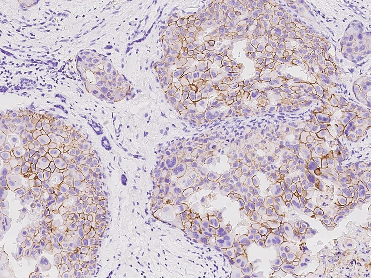 Monoclonal Rabbit anti-Human ERBB2 / HER2 Antibody (clone 002, Preservative Free, aa1-652, IHC, IF)