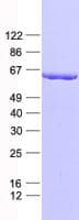 Human CNOT2 Protein (Recombinant His, N-Terminal)