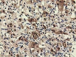 EPHX2 / Epoxide Hydrolase 2 Antibody (clone OTI1A6, Carrier-free)