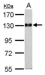 Polyclonal Rabbit anti-Human AMPH / Amphiphysin Antibody (aa1-194, IHC, WB)