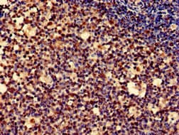 Polyclonal Rabbit anti-Human PDLIM2 / SLIM Antibody (IHC)