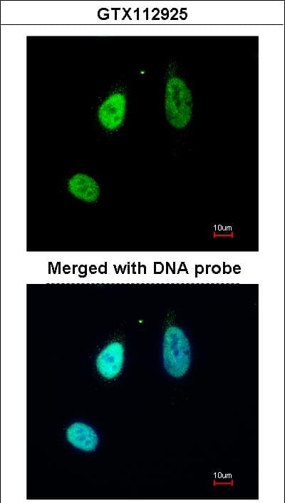 IHC-plus™ ERG Antibody