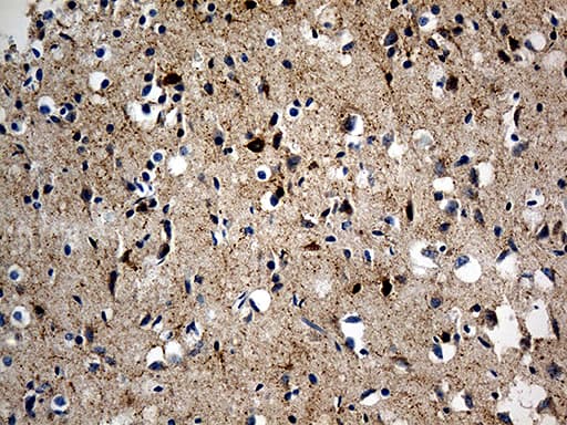 SCG2 / Secretogranin II Antibody (aa31, clone OTI3F12)