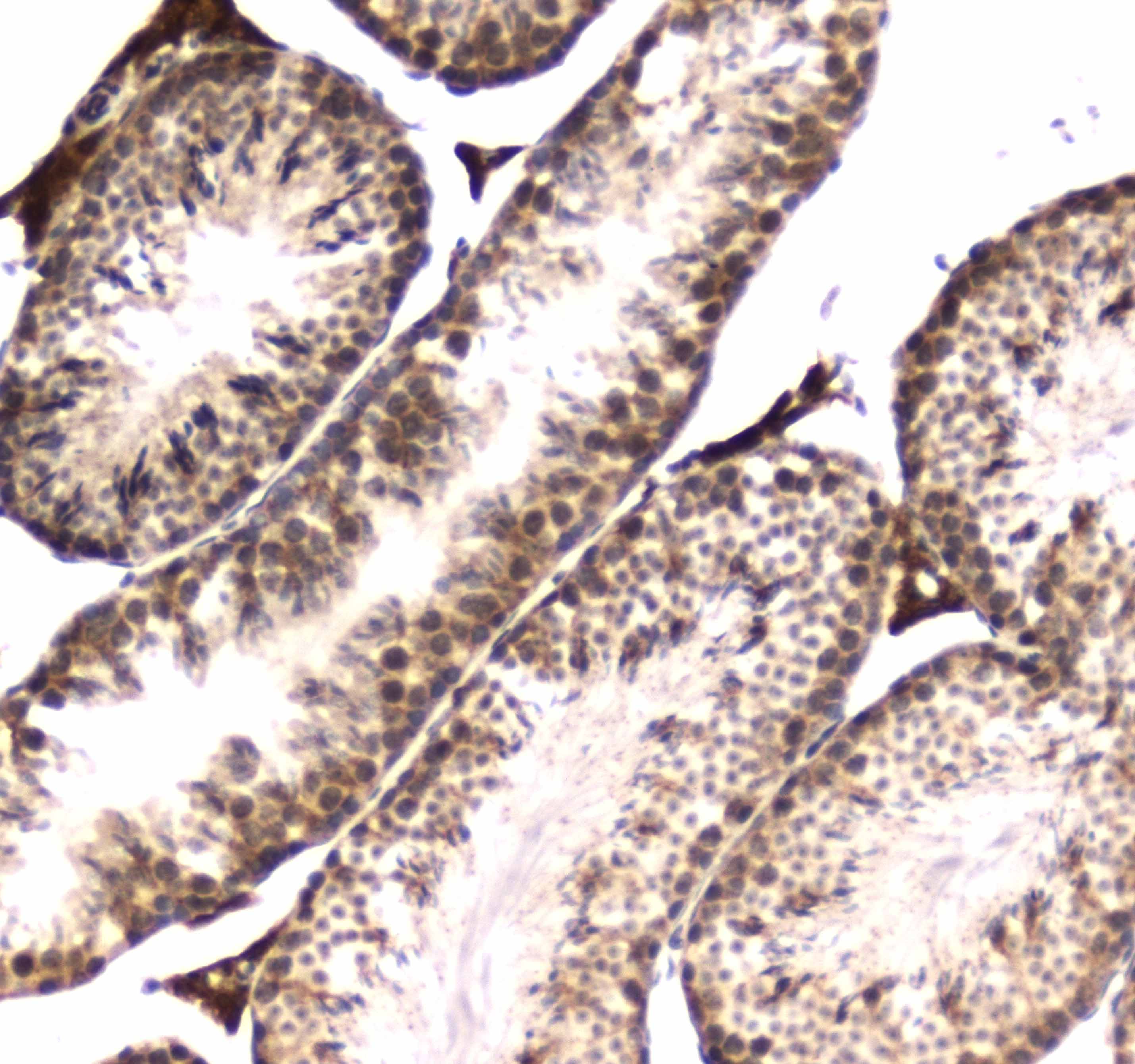 POLR2A / RNA polymerase II Antibody