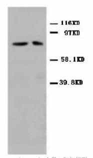 Mitofusin 2 / MFN2 Antibody (N-Terminus)