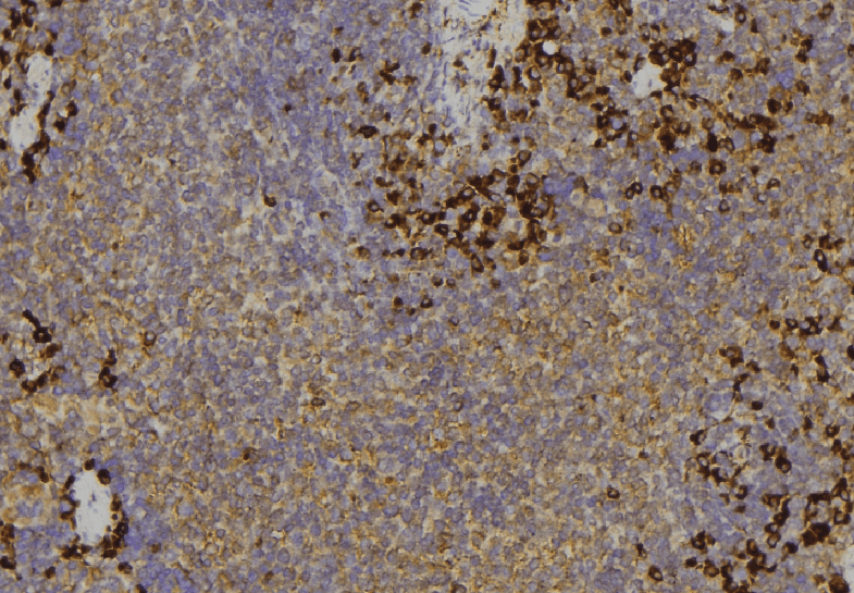 MYO5C Antibody