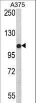 TECPR1 Antibody (aa162-189)