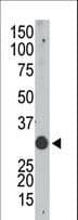 APOBEC1 Antibody (aa7-36)