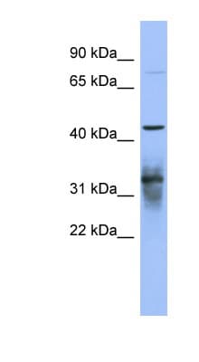 PABPC5 Antibody (aa71-120)