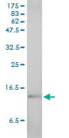 SAA1 / SAA / Serum Amyloid A Antibody (clone 3C11-2C1)