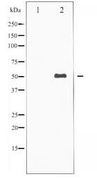 Polyclonal Rabbit anti-Human KRT8 / CK8 / Cytokeratin 8 Antibody (IHC, IF, WB)