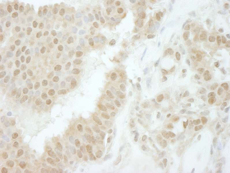 Polyclonal Rabbit anti-Human TIPRL / TIP Antibody (aa225-C-term, IHC)