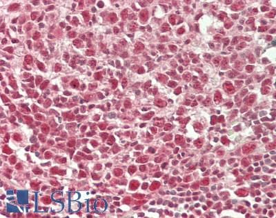 IHC-plus™ WDR5 Antibody (aa50-100)