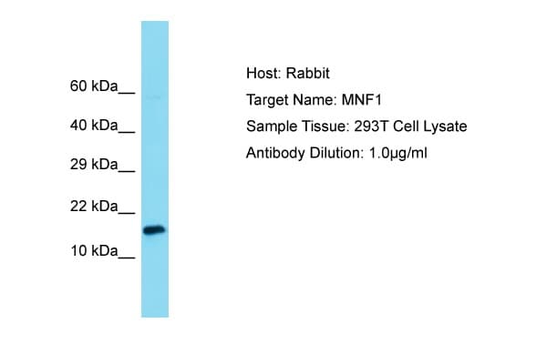Polyclonal Rabbit anti-Human UQCC2 / MNF1 Antibody (C-Terminus, WB)