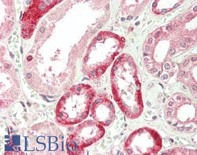IHC-plus™ Monoclonal Mouse anti-Human TNFRSF14 / CD270 / HVEM Antibody (clone ANC3B7, Azide-free, IHC)