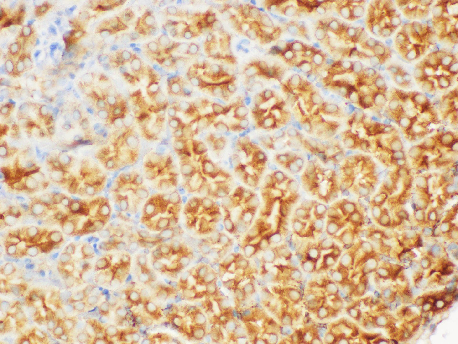 FGB / Fibrinogen Beta Chain Antibody