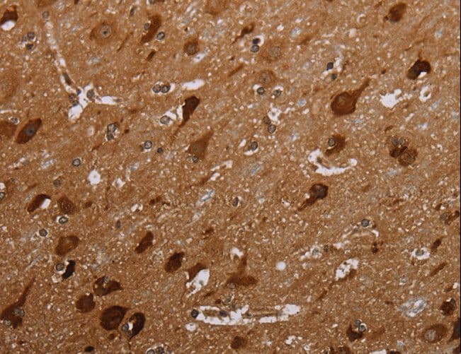 MAGEC2 / CT10 Antibody