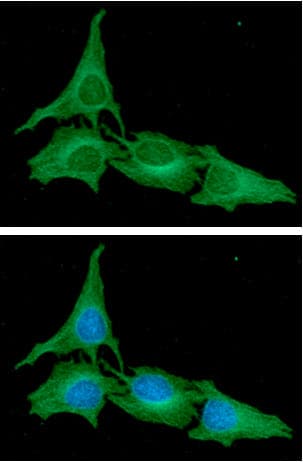Monoclonal Mouse anti-Human ATG3 Antibody (clone AT15F6, WB)