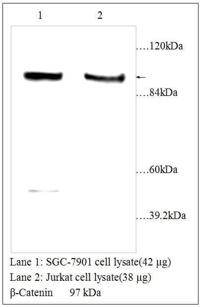 CTNNB1 / Beta Catenin Antibody