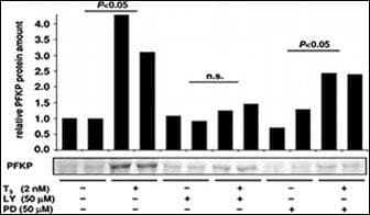 IHC-plus™ PFKP Antibody (aa754-784)