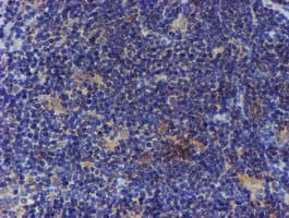 ER Alpha / Estrogen Receptor Antibody (clone OTI1B1)
