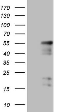 NR2E3 / PNR Antibody (clone OTI3D9)