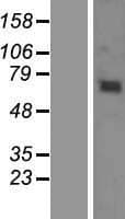 KBTBD6 Protein (Over-Expression Lysate Myc-DDK (Flag))