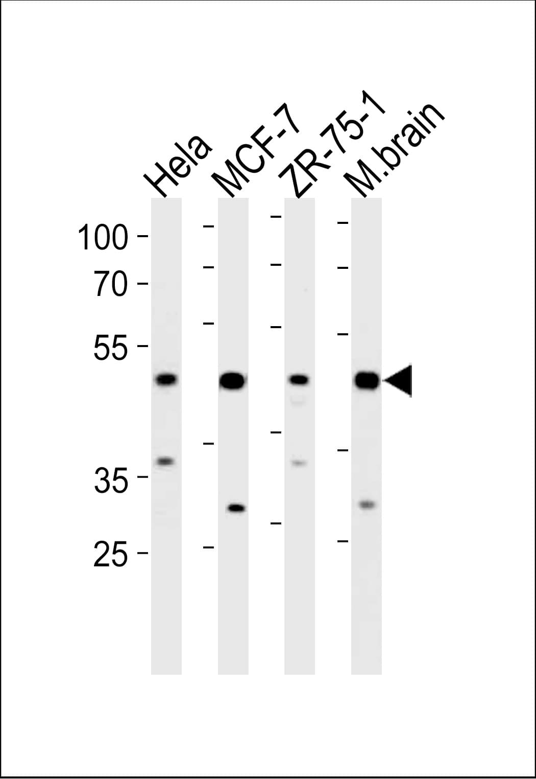 Polyclonal Rabbit anti-Human FBXO28 Antibody (aa339-368, WB)