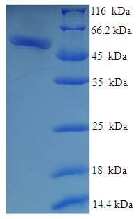 Human GALM / Mutarotase Protein (Recombinant His-SUMO)
