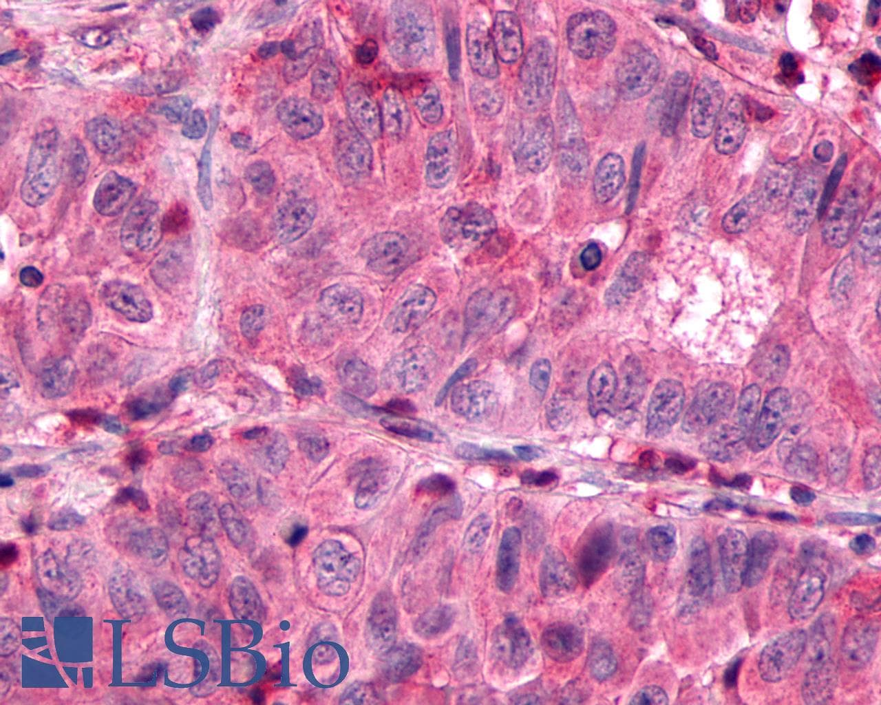 PathPlus™ SSTR3 Antibody (C-Terminus)