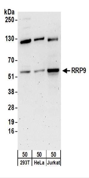 RRP9 Antibody (aa175-225)