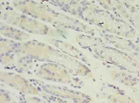 RANBP2 / TRP1 Antibody