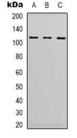 EPHA1 / EPH Receptor A1 Antibody