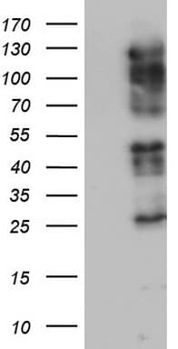 Monoclonal Mouse anti-Human ZEB1 / AREB6 Antibody (clone OTI8H8, aa1-350, WB)