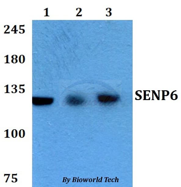 SENP6 Antibody