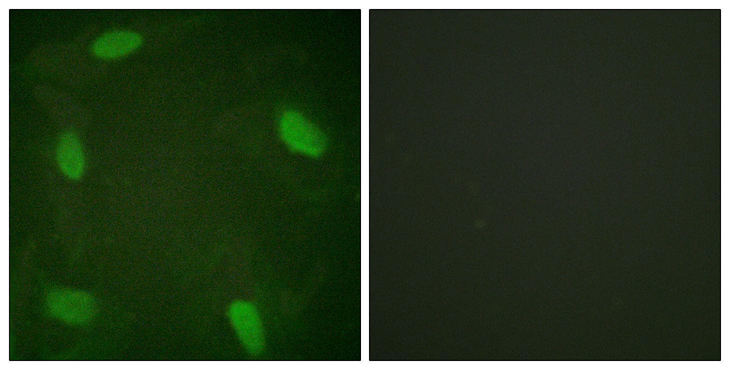 SSB / La Antibody (phospho-Ser366)