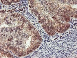 GRAP2 / GRID Antibody (clone OTI1G2)