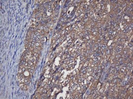 CRYAA / Alpha A Crystallin Antibody (clone OTI2C3)