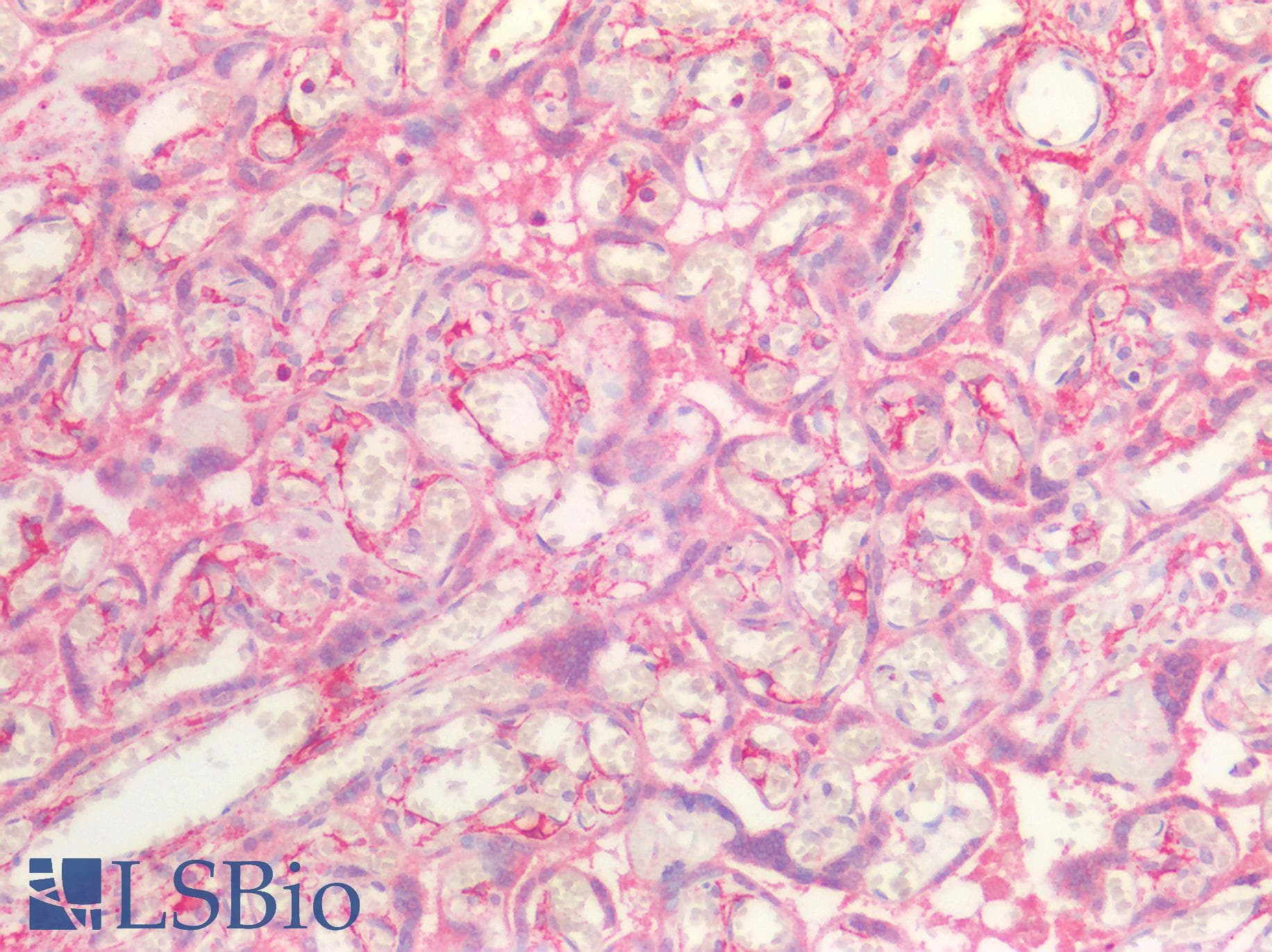 IHC-plus™ Polyclonal Rabbit anti-Human PDPN / Podoplanin Antibody (IHC, WB)