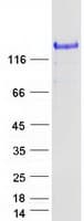 Human SPARCL1 / Hevin Protein (Recombinant Myc-DDK (Flag))