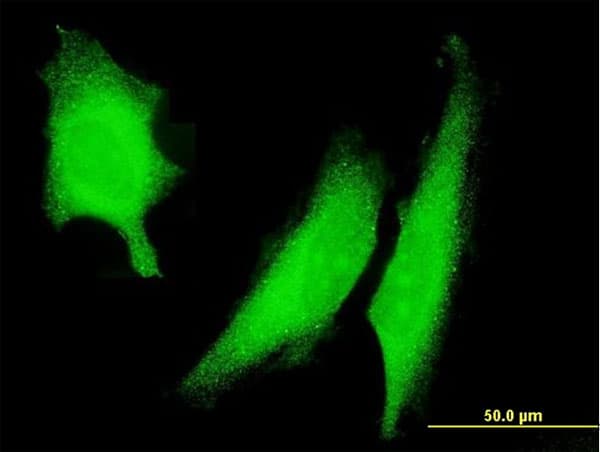 PRKAA2 / AMPK Alpha 2 Antibody (clone 1G8)