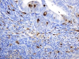 TP / Thymidine Phosphorylase Antibody (aa311-482, clone 7A6, Carrier-free)