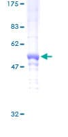 Human DDAH2 Protein (Recombinant GST)