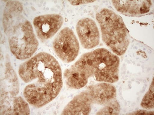 PROZ / Protein Z Antibody (aa115-400, clone OTI4F1)