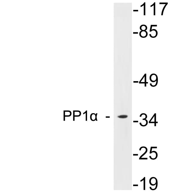 PPP1CA / PP1-Alpha Antibody (aa271-320)