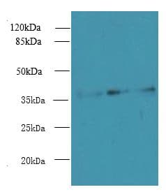 LDAH Antibody