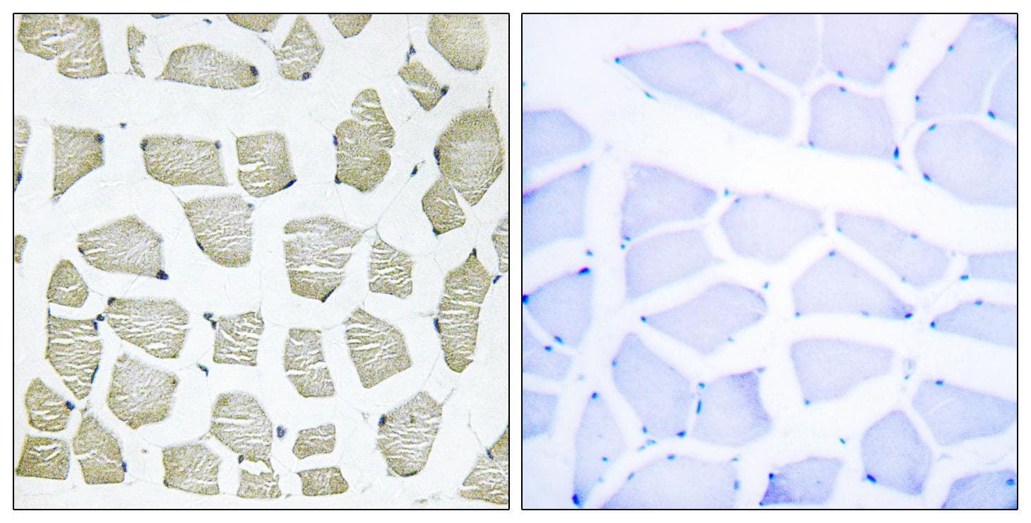 Polyclonal Rabbit anti-Human ITIH4 Antibody (Cleaved-Arg661, IHC)