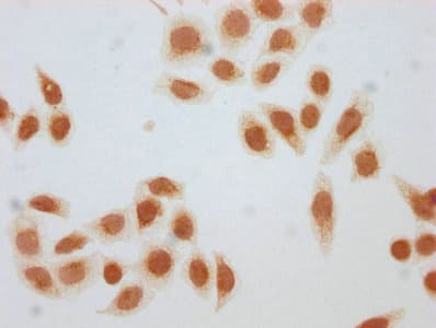 HIST1H1E Antibody