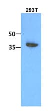 ACOT7 / BACH Antibody (clone AT1D5)
