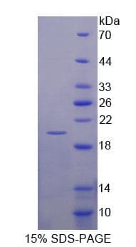 Mouse CHRDL2 Protein (Recombinant His-T7)